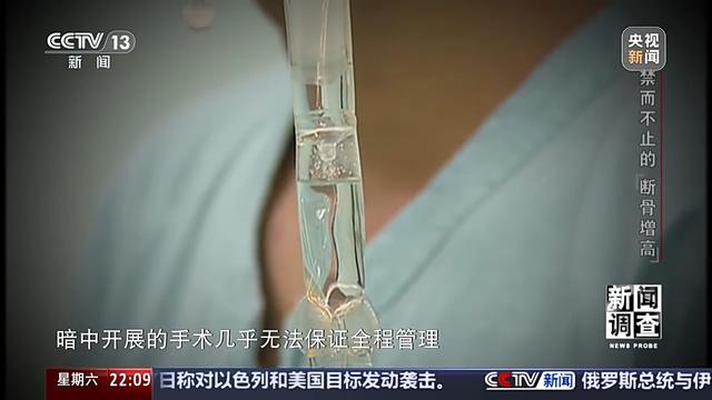 术后麻烦不断，禁而不止的“断骨增高” 有多坑？