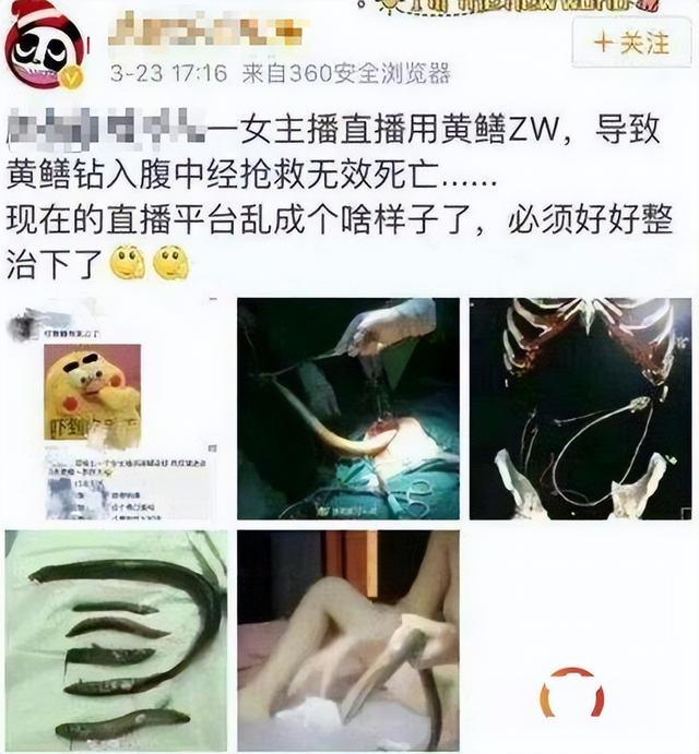 “黄鳝门”事件曝光，警方严查淫秽直播平台