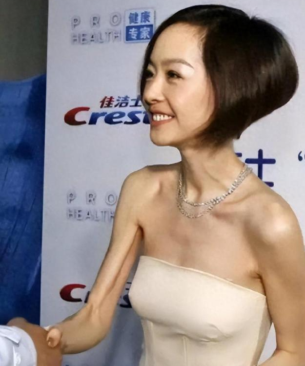 滤镜下是美女，现实中是“女鬼”！这些瘦到病态的明星，真恐怖